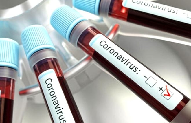 Koronavirüs bakın en çok hangi hastalığı olanları öldürüyor? 11