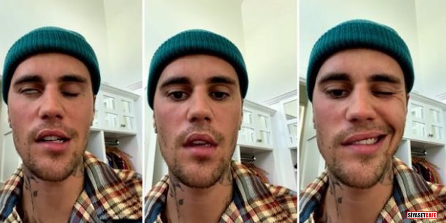 Dünyaca ünlü şarkıcı Justin Bieber yüz felci oldu