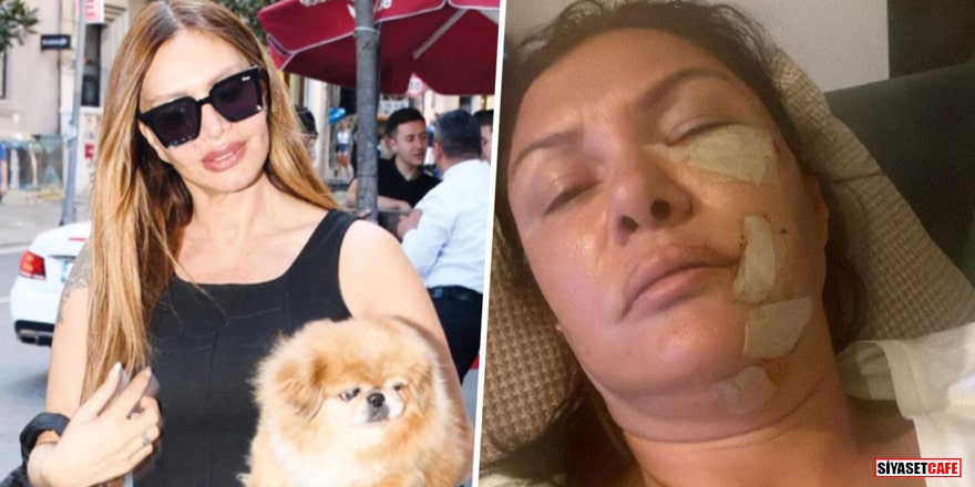 Sevda Demirel: Tuğba Altıntop köpek saldırısına uğramamış, dayak yemiş
