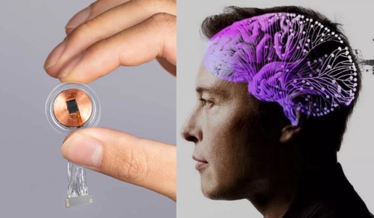 Elon Musk'ın tartışmalı beyin çipi için insan deneyleri başlıyor