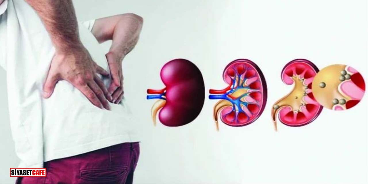 Böbreklerinizi Sessizce Yok Eden 7 Hata! Siz Kaç Tanesini Yapıyorsunuz?