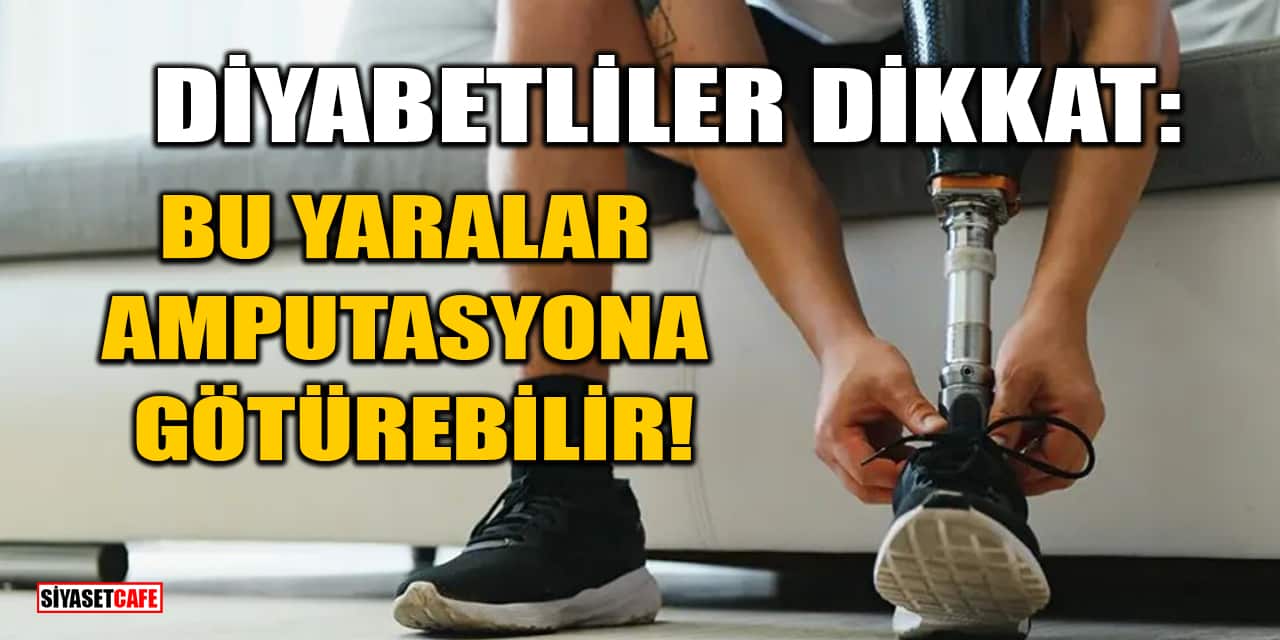 Diyabetliler Dikkat: Bu Yaralar Amputasyona Götürebilir!