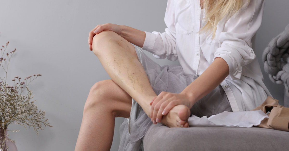 Varis Ve Lipödem'e Zemin Hazırlayan 8 Etken!