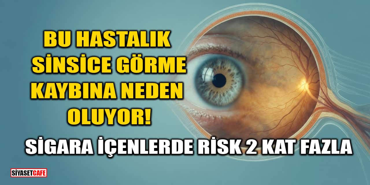 Bu Hastalık Sinsice Görme Kaybına Neden Oluyor! Sigara İçenlerde Risk 2 Kat Fazla​​​​​​​