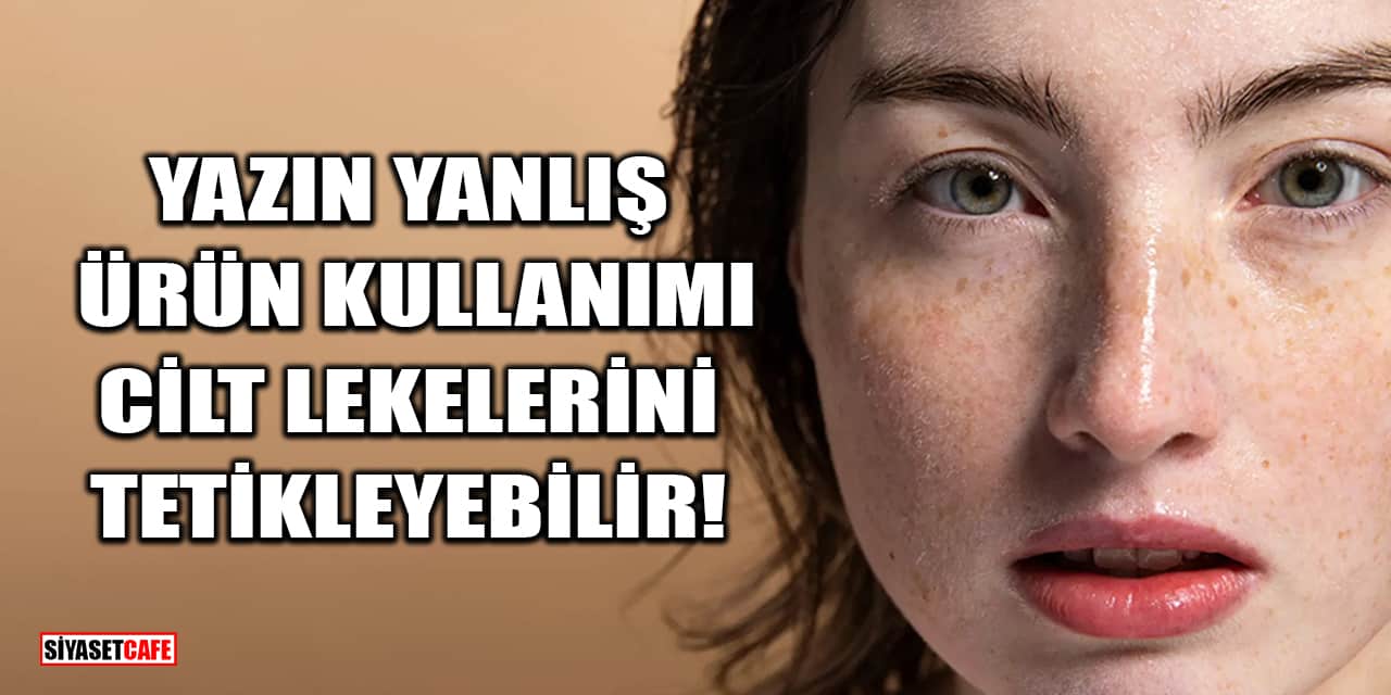 Yazın Yanlış Ürün Kullanımı Cilt Lekelerini Tetikleyebilir!