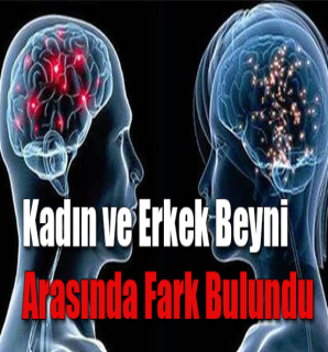 Kadın ve erkek beyinleri arasındaki farklılıklar