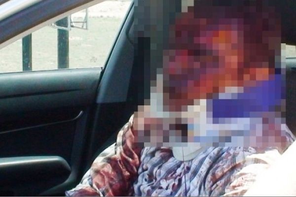 Birbirlerinin kulaklarını bıçakla kopardılar