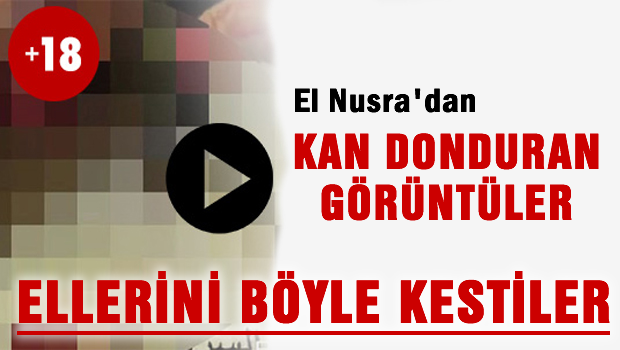 Suriye'den Kan Donduran görüntüler