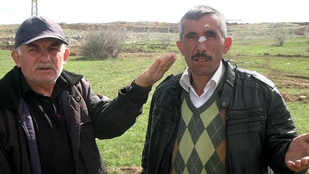 AKP'li vekil seçmenini dövdürdü