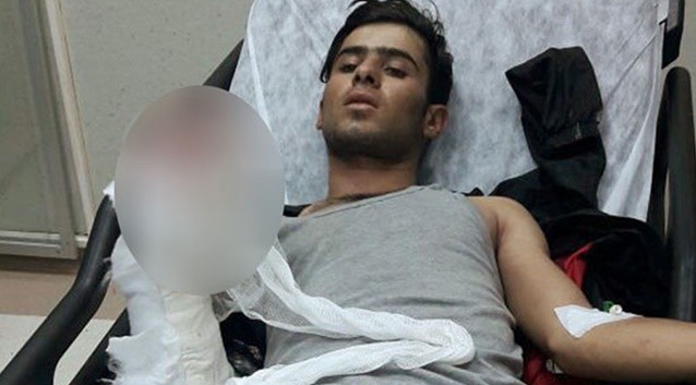 Karakola atacağı bomba elinde patladı