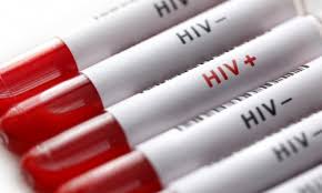 Dünyada en fazla HIV taşıyıcısı Doğu ve Güney Afrika'da
