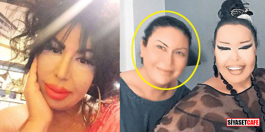 Diva'ya benzemek için 10 kez ameliyat oldu!