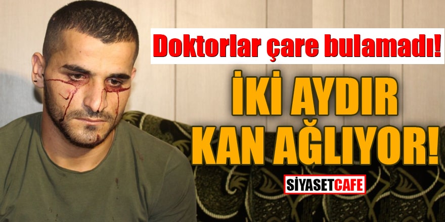 Doktorlar çare bulamadı İki aydır kan ağlıyor