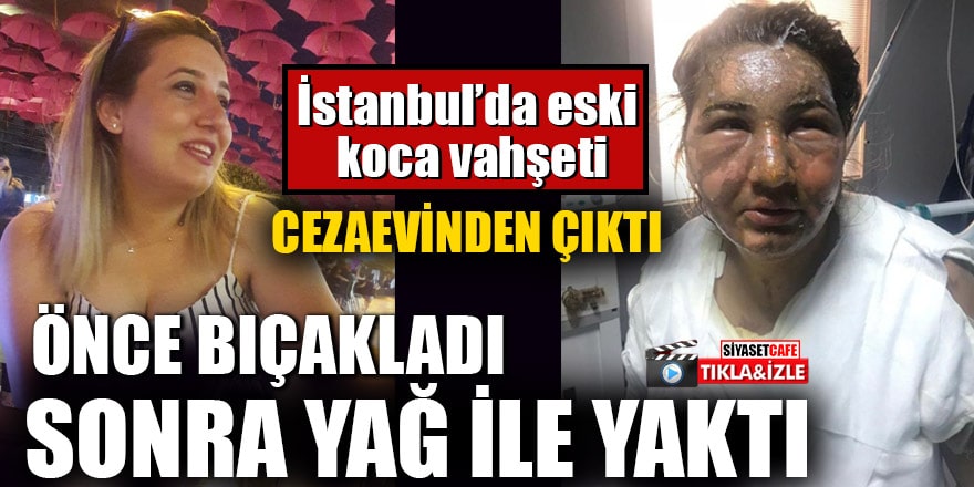 İstanbul’da eski koca vahşeti: Cezaevinden çıktı önce bıçakladı sonra yağ ile yaktı