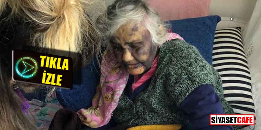Zonguldak'ta yürek sızlatan görüntü; zavallı kadını bu hale getirmişler!