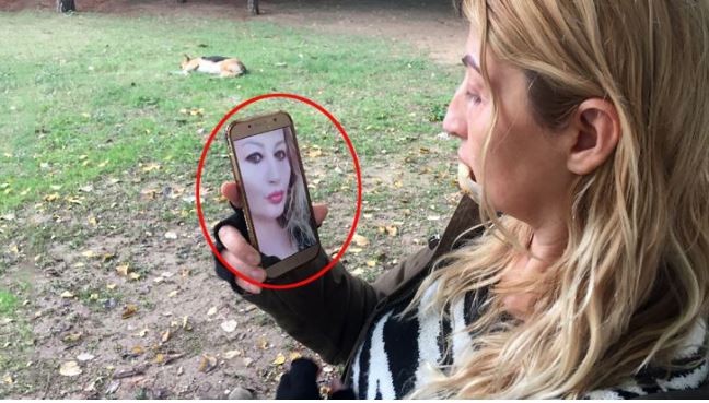 Antalya'da genç kadın estetik uğruna alt dudağını tamamen kaybetti