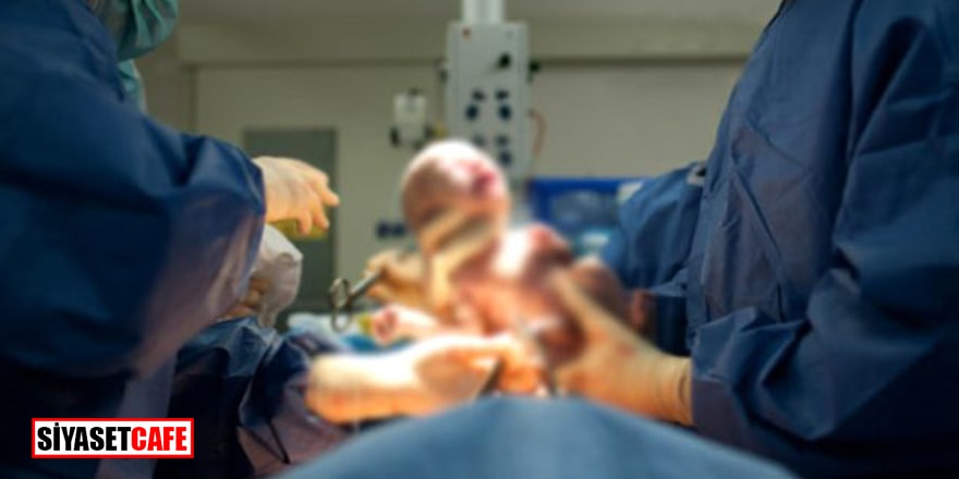 Doktorlar doğum sırasında bebeğin yüzünü kesti
