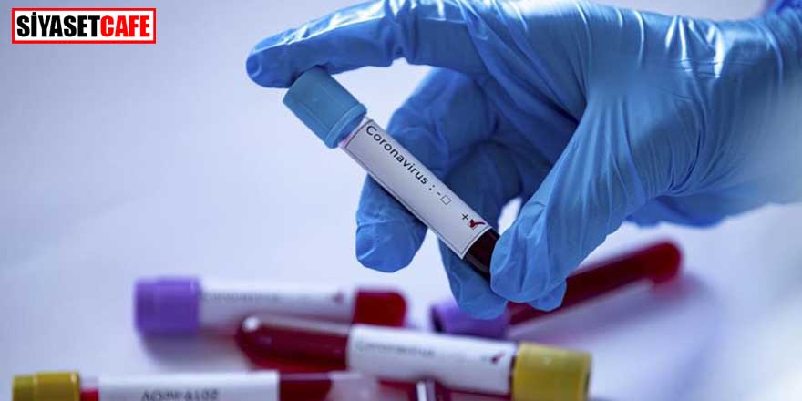 ABD' şirketinin ürettiği 2 dakikada sonuç veren koronavirüs testine onay