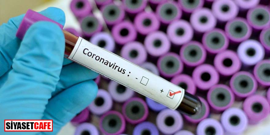 İBB’de 350 kişinin koronavirüs testi pozitif çıktı