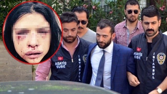 Onur Özbizerdik manken sevgilisini hastanelik etti!