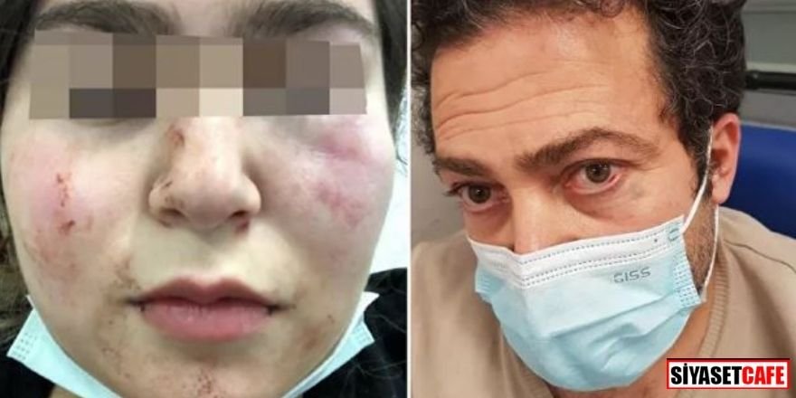 Almanya'da korkunç olay: Polis Türk aileyi hastanelik etti