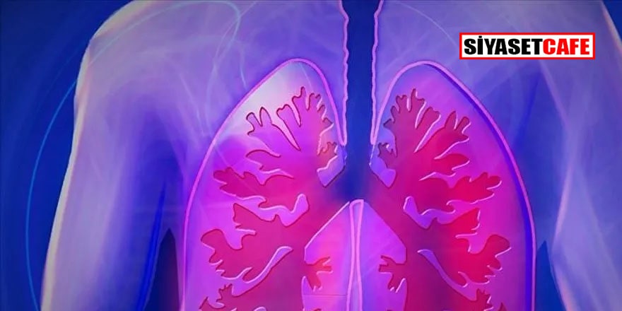 Bilim Kurulu Üyesi: Aşılanmamış grup çok büyük akciğer enfeksiyonuyla karşımıza geliyor