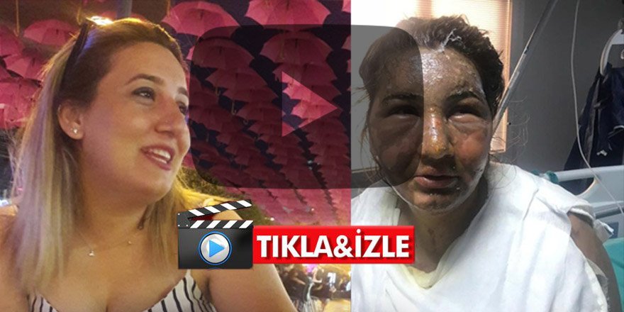 İstanbul’da eski koca vahşeti: Cezaevinden çıktı önce bıçakladı sonra yağ ile yaktı