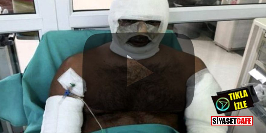 Lahmacun fırını bomba gibi patladı