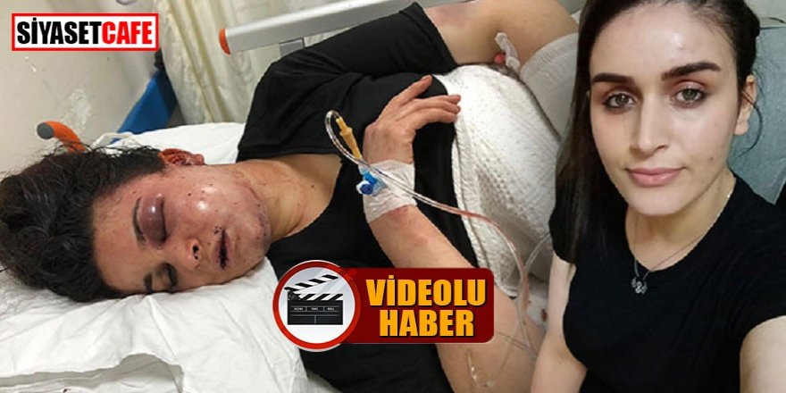 Boşanmak istediği kocası dehşeti yaşattı