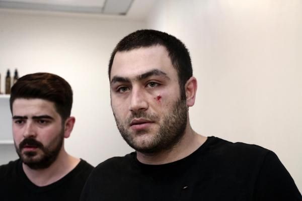 AKP'li vekilin elini sıkmadı dayağı yedi