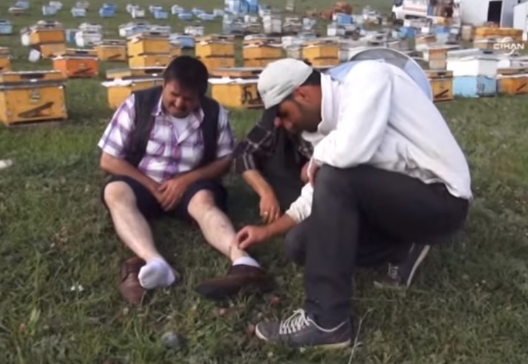 Arı zehrinden doğan şifa